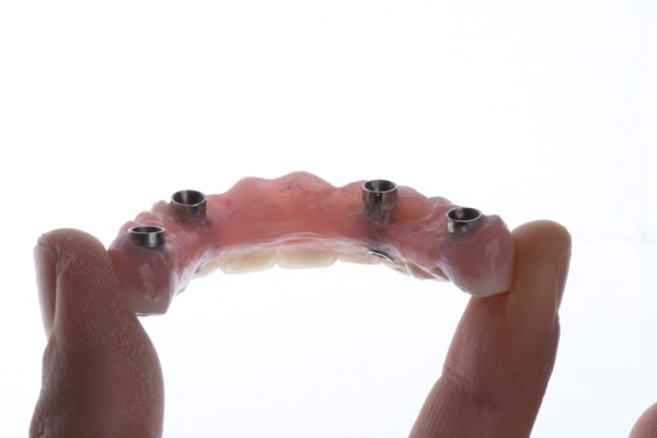 How Many Implants Are Needed For Lower Implant Supported Dentures?