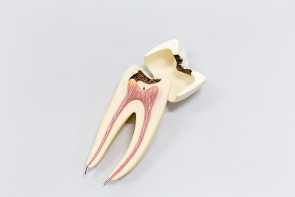 What Happens After The Root Canal Procedure?