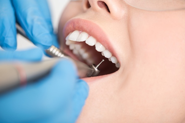 What Is A Tooth Filling Made From?